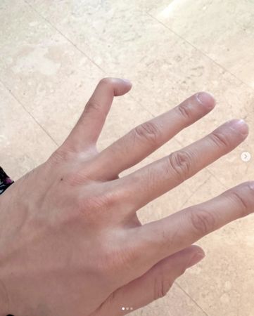 ▲林俊傑曬出手指受傷照。（圖／翻攝自Instagram／jjlin）