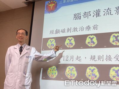 腦中風10年手舉不起來　他靠「肉毒注射合併經顱磁刺激」恢復功能