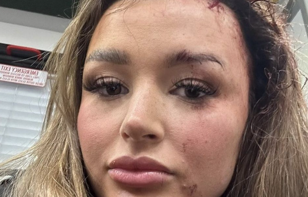 24歲女網紅在網路「分享自拍照」　莫名遭男重擊後腦勺爆血送醫。（圖／翻攝自Instagram／charleenmurphy）