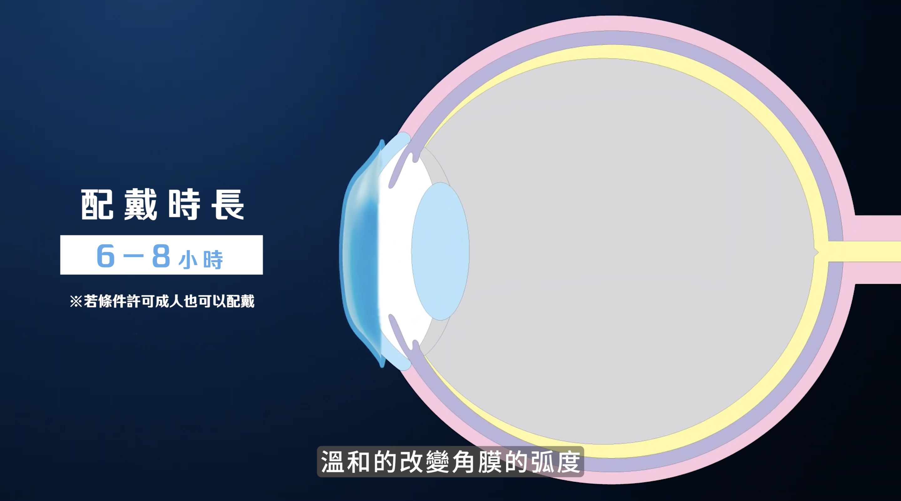 ▲▼大學眼科,視力,兒童,角膜塑型,鍾欣怡,近視,矯正。（圖／翻攝自影片）