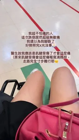 ▲林佩瑤跌倒造成肌腱受傷。（圖／翻攝自Instagram／林佩瑤 Pei Yao Lin）