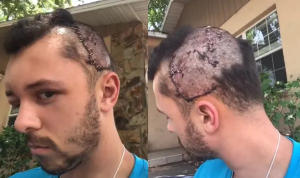 27歲男河中遭巨鱷攻擊「2口瞬間碎頭骨」　靠頭上 GoPro救命。（圖／翻攝自TikTok／wildernessjeff）