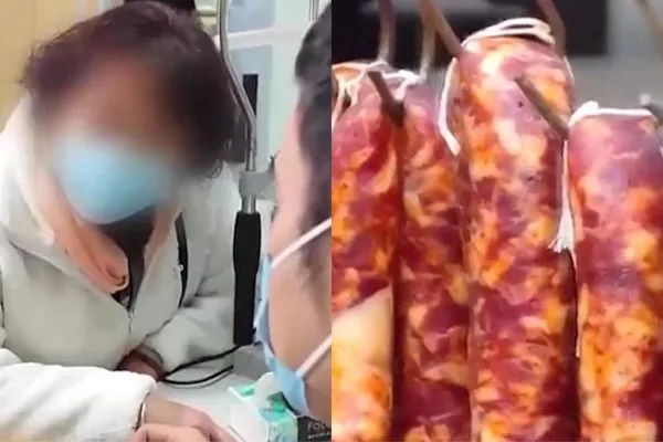 ▲女子連吃一週臘腸導致左眼失明。（圖／翻攝自星視頻）