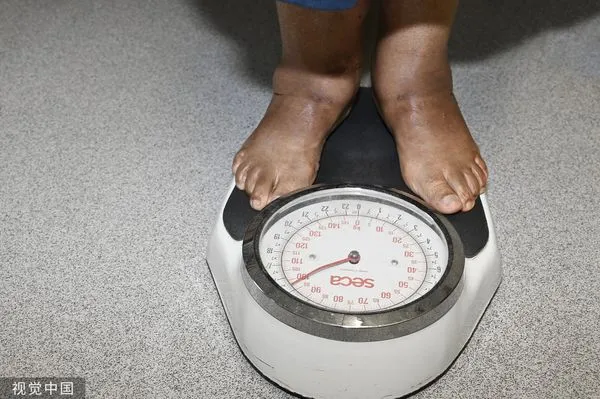 ▲▼量體重,減肥。（圖／CFP）