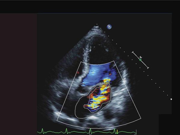 ▲診所醫師王愛軍（左）發現患者心臟有明顯雜音，可能有內膜炎造成的問題，轉診至彰基。（示意圖／彰基提供）