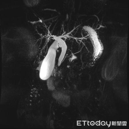 ▲▼義大醫院吸毒黃疸             。（圖／記者陳宏瑞攝）