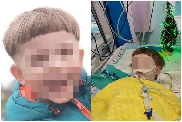 ▲▼烏克蘭5歲男童因為拔牙手術喪命。（圖／翻攝自Facebook／Viktor Pashnyk）