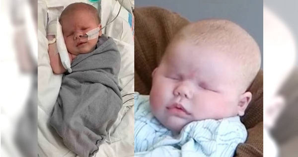 女兒出生後沒睜眼　新手媽被護理師「子宮很黑」打發　檢查驚：寶寶天生沒眼球