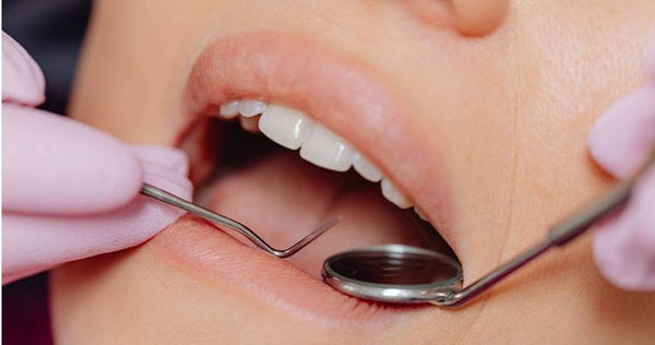盧滄洲牙醫師破解常見洗牙迷思，一般情況下牙齒的琺瑯質並不會因此而受傷。（圖／報系資料照）