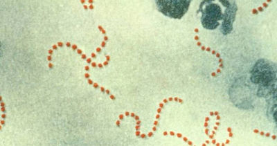 日本爆發「食人菌」疫情！台大醫示警6類人：死亡風險高