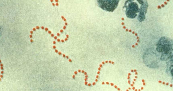 治療A型溶血性鏈球菌，一定要完成10添抗生素療程。（圖／翻攝自維基百科）
