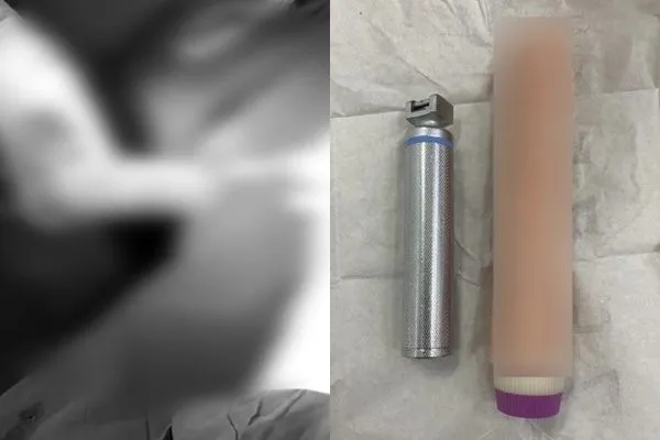 ▲▼越南一名男子將假陽具塞入體內，不料卻導致肛門被卡住，讓他痛不欲生。（圖／翻攝自Tuoi Tre Online）