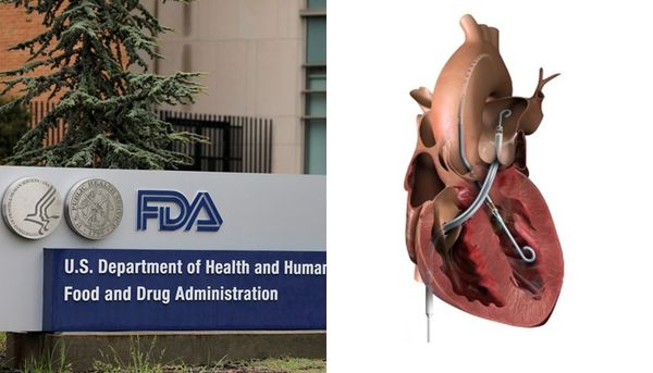 ▲▼美國FDA警告，Abiomed所生產的心室輔助器可能會造成心臟穿孔。（圖／翻攝自Abiomed）