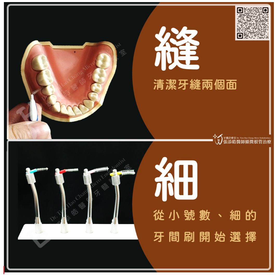 牙間刷使用時機。（圖／張添皓醫師顯微根管治療中心）