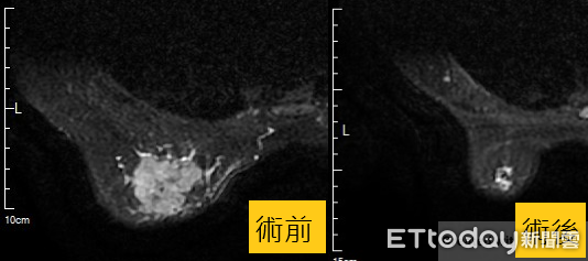 ▲長安醫院乳房外科醫師李育嘉。（圖／長安醫院提供）