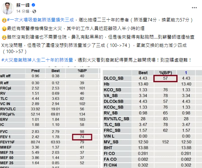 ▲該患者肺活量減少三成。（圖／翻攝自臉書／蘇一峰）