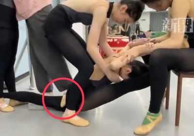 17歲舞蹈生「被老師踩斷腿」無法再跳　老師：只願賠22萬元