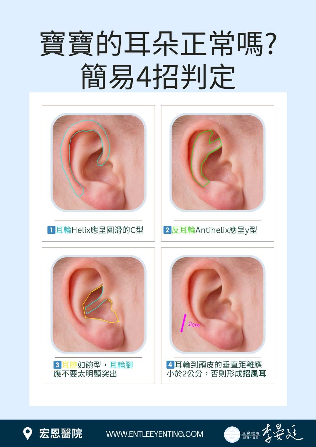 簡易判斷寶寶耳朵是否正常。（圖／李晏廷醫師提供）