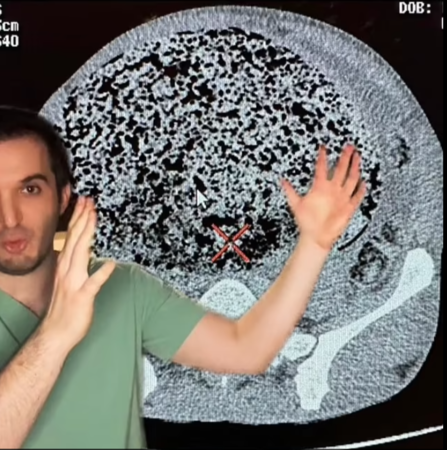 ▲▼男子3個月沒大便。（圖／翻攝自TikTok）