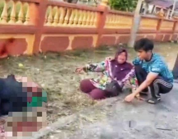 ▲▼大馬瓜拉登嘉樓（Kuala Terengganu）的18歲少年騎車被撞斷左腿。（圖／翻攝自IG）