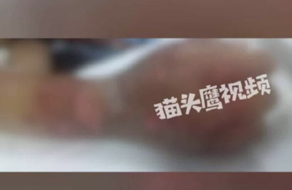 ▲▼陸少年遭11盆開水淋身！8學長「逼穿長袖隱瞞」化膿潰爛才曝光。（圖／翻攝微博）