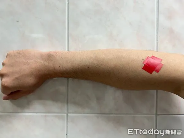 ▲網球肘學名為「肱骨外上髁炎」。（圖／台中榮總埔里分院提供）