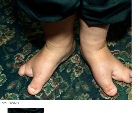 希腊脚好丑图片