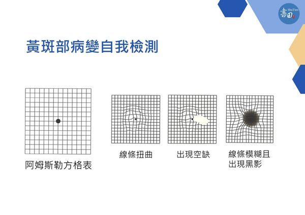 ▲▼黃斑部病變自我檢測。（圖／書田診所提供）