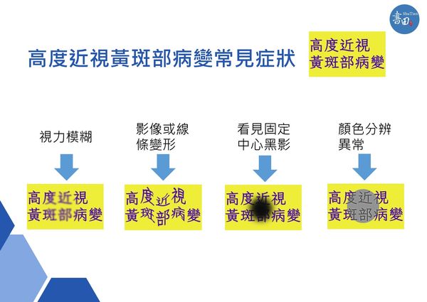 ▲▼高度近視黃斑部病變常見症狀。（圖／書田診所提供）