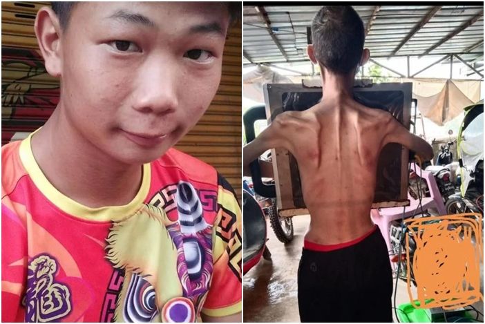 ▲▼ 馬來西亞28歲男子李冠華被賣去緬甸當豬仔，獲救返國後，摔倒過世。（圖／翻攝自星洲網）