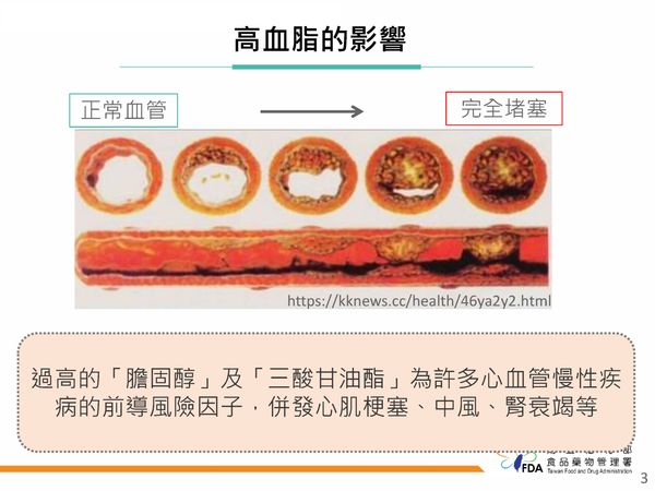 ▲▼高血脂影響。（圖／食藥署提供）