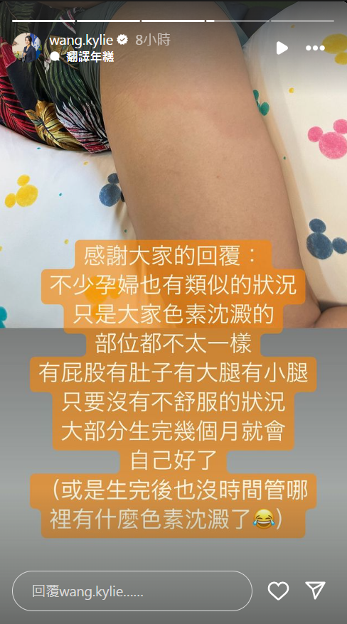 ▲▼《百靈果》凱莉生產倒數「大腿泛紅不褪色」求助網友。（圖／翻攝自Instagram／wang.kylie）