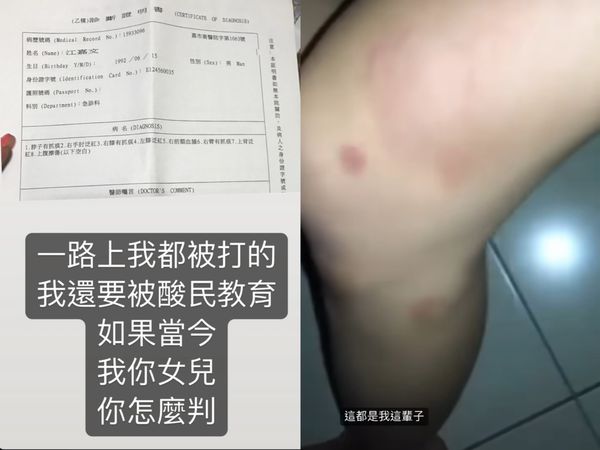 ▲▼罔腰爆之前遭鳳梨毆打。（圖／翻攝自罔腰IG）