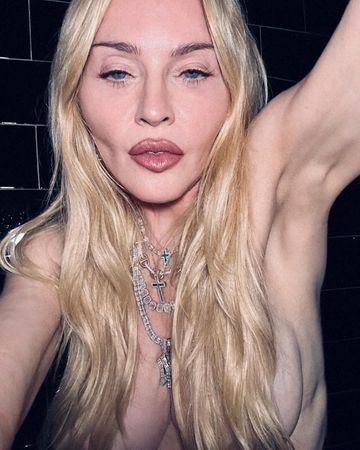 ▲瑪丹娜臉蛋近況掀起熱烈討論。（圖／翻攝自Madonna Instagram）