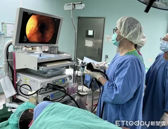 ▲老婦吃藥時不慎連鋁箔包裝一起吞下、卡在食道，所幸就醫透過胃鏡順利取出。（圖／衛福部南投醫院提供）