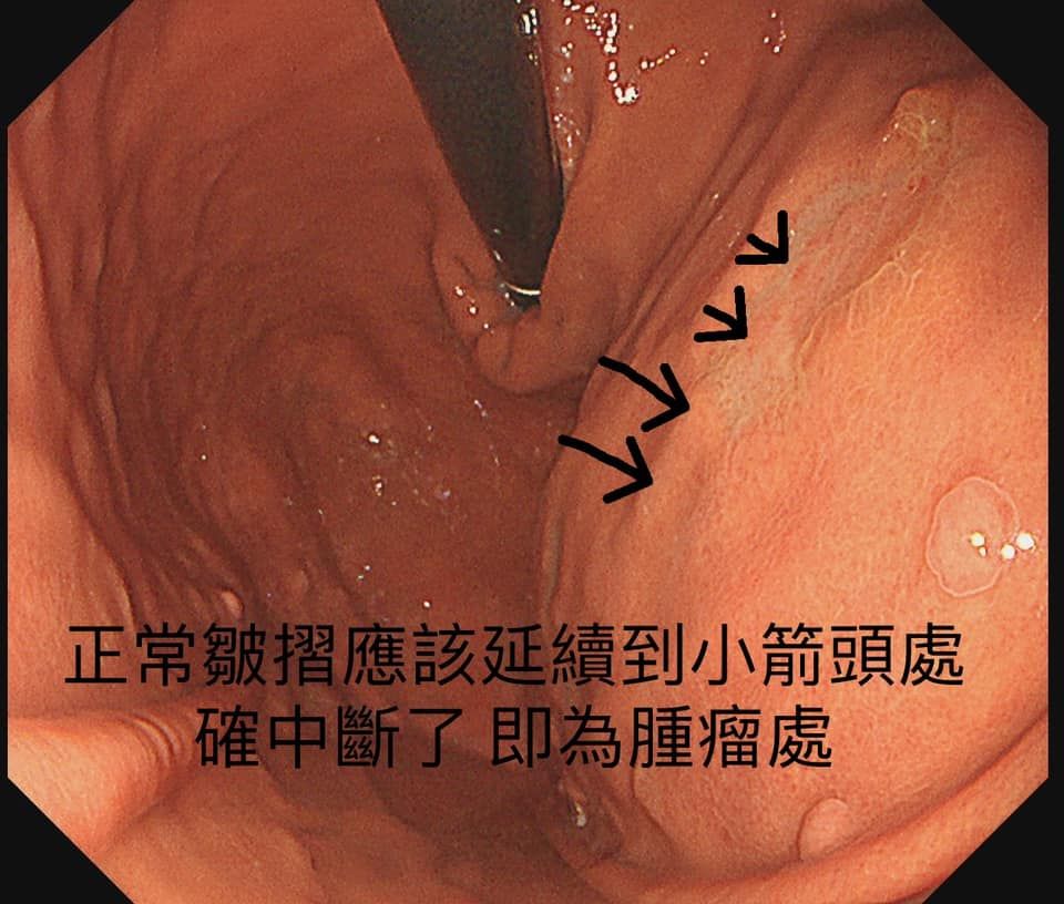 （圖／翻攝林相宏臉書）