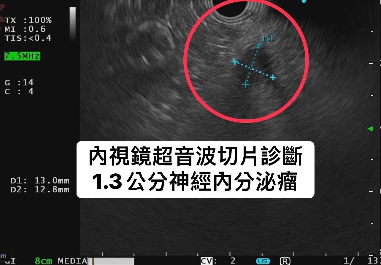 （圖／翻攝「胰臟醫師 林相宏 禾馨民權內科診所」臉書）