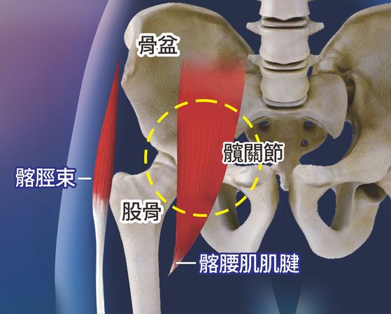 ▲▼有患者跌倒，髖關節肌肉韌帶受傷。（圖／員榮醫院提供）