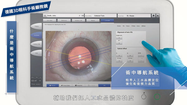 ▲▼蔡司眼科手術顯微鏡。（圖／擷取自客製化影音）