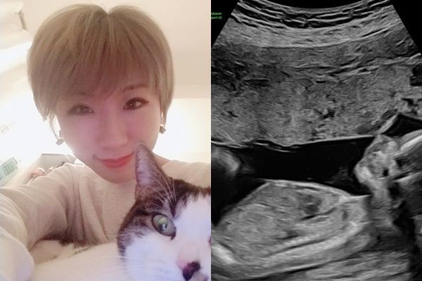 外送稿用▲廣告小妹三年前不幸流產！　今驚喜曬照「宣布懷孕」哭喊：等了三年。（圖／翻攝自Facebook／凡槿（廣告小妹））