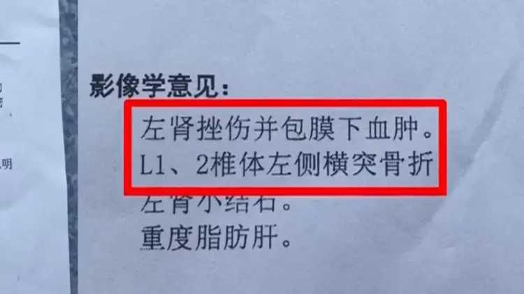 男子路邊吃東西被樹葉砸到骨折　網一看「凶器照」驚呼：嚴重會死人