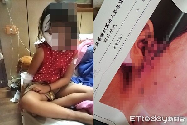 ▲雲林一名7歲女童跑到隔壁鄰居家找朋友，遭鄰居飼養的秋田犬咬成重傷。（圖／記者王悉宇翻攝）