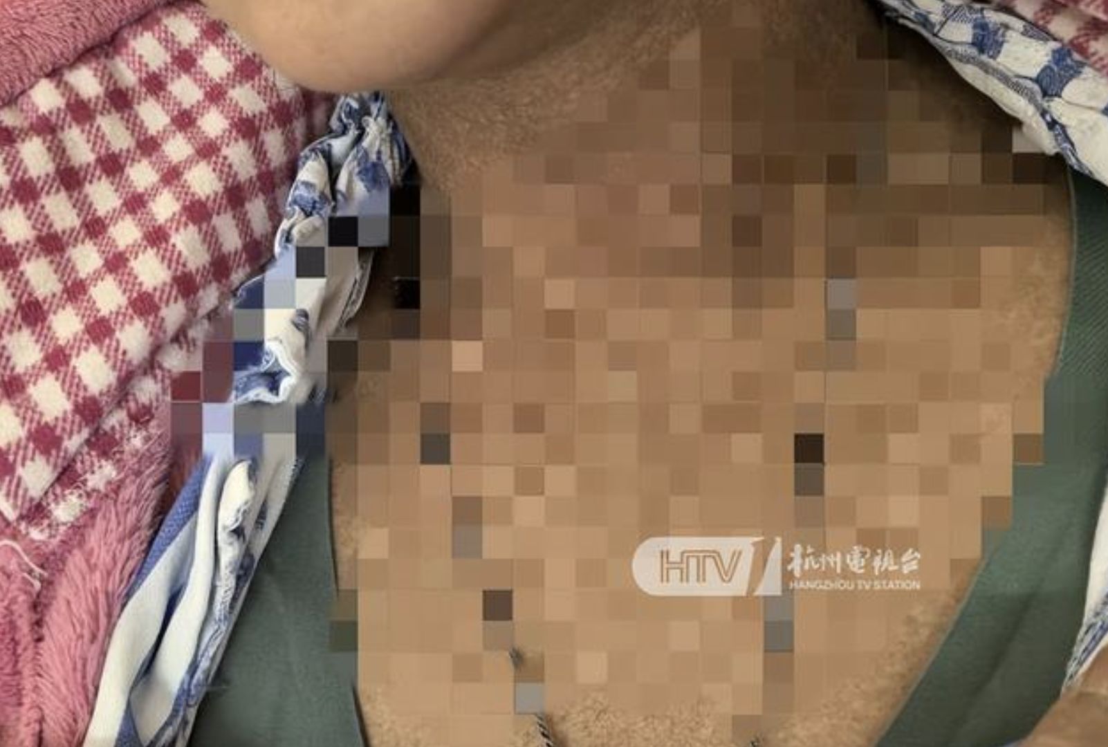 ▲杭州一名女子長期服用牛黃解毒丸造成砷中毒，也就是俗稱的「砒霜」中毒。（圖／翻攝魯中晨報）