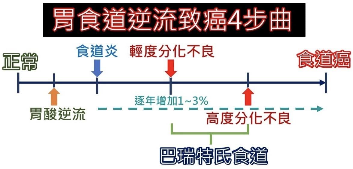 ▲他照胃鏡驚現「一整片鮭魚色」　醫警告：是癌前病變。（圖／張靖醫師授權提供）