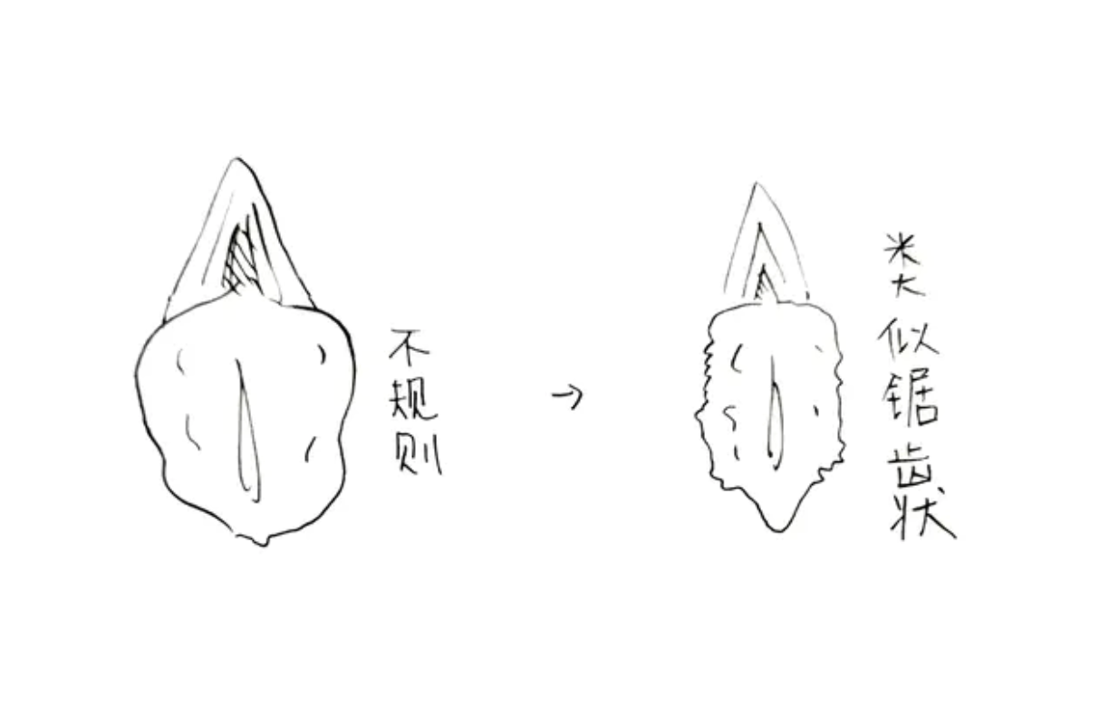 ▲原PO表示，手術後下體變成「鋸齒狀」。（圖／翻攝自Dcard）