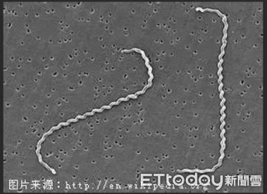 ▲狗食慾差拉肚子！檢查竟感染「鉤端螺旋體」　醫提醒這2處超危險（圖／新北市動保處提供）