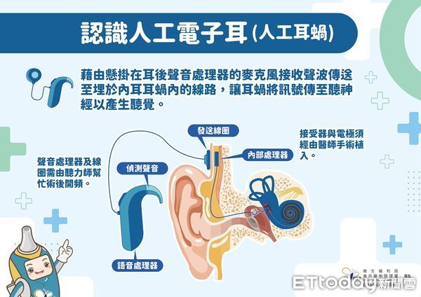 人工電子耳衛教資訊。（圖／食藥署提供）