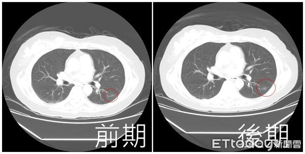 ▲劉柏毅,亞大附醫,胸腔外科。（圖／亞大附醫）