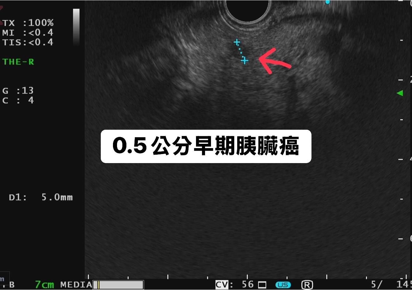 （圖／翻攝「胰臟醫師 林相宏 禾馨民權內科診所」臉書）