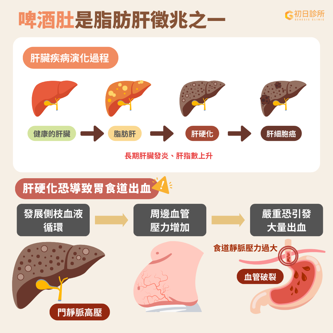 ▲啤酒肚是脂肪肝前兆？逆轉內臟脂肪4招教給你！（圖／初日診所授權提供）